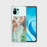 Capinha de Celular Xiaomi Mi 11 Lite 5G