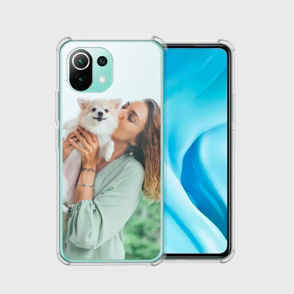 Capinha de Celular Xiaomi Mi 11
